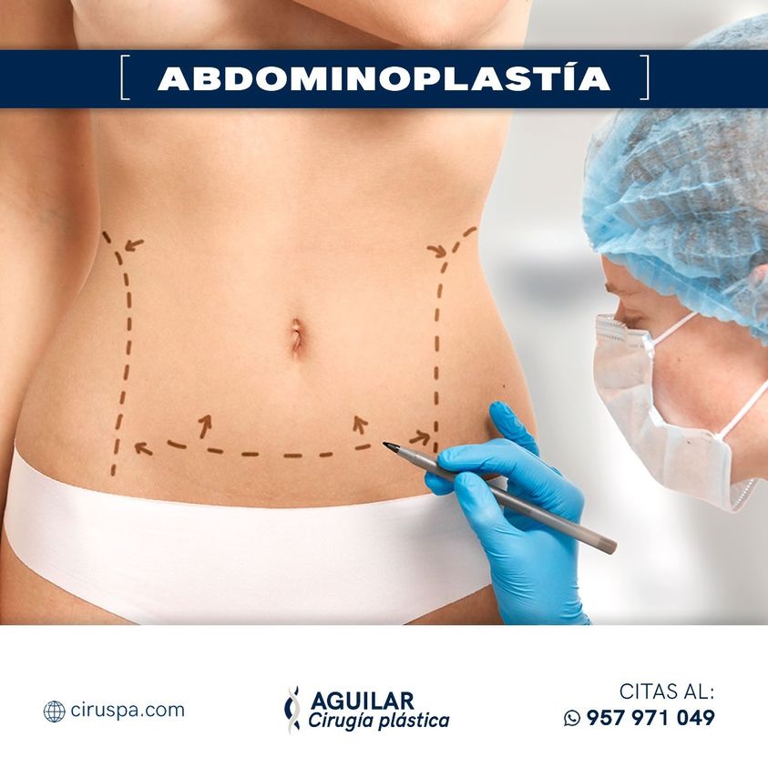 abdominoplastia1