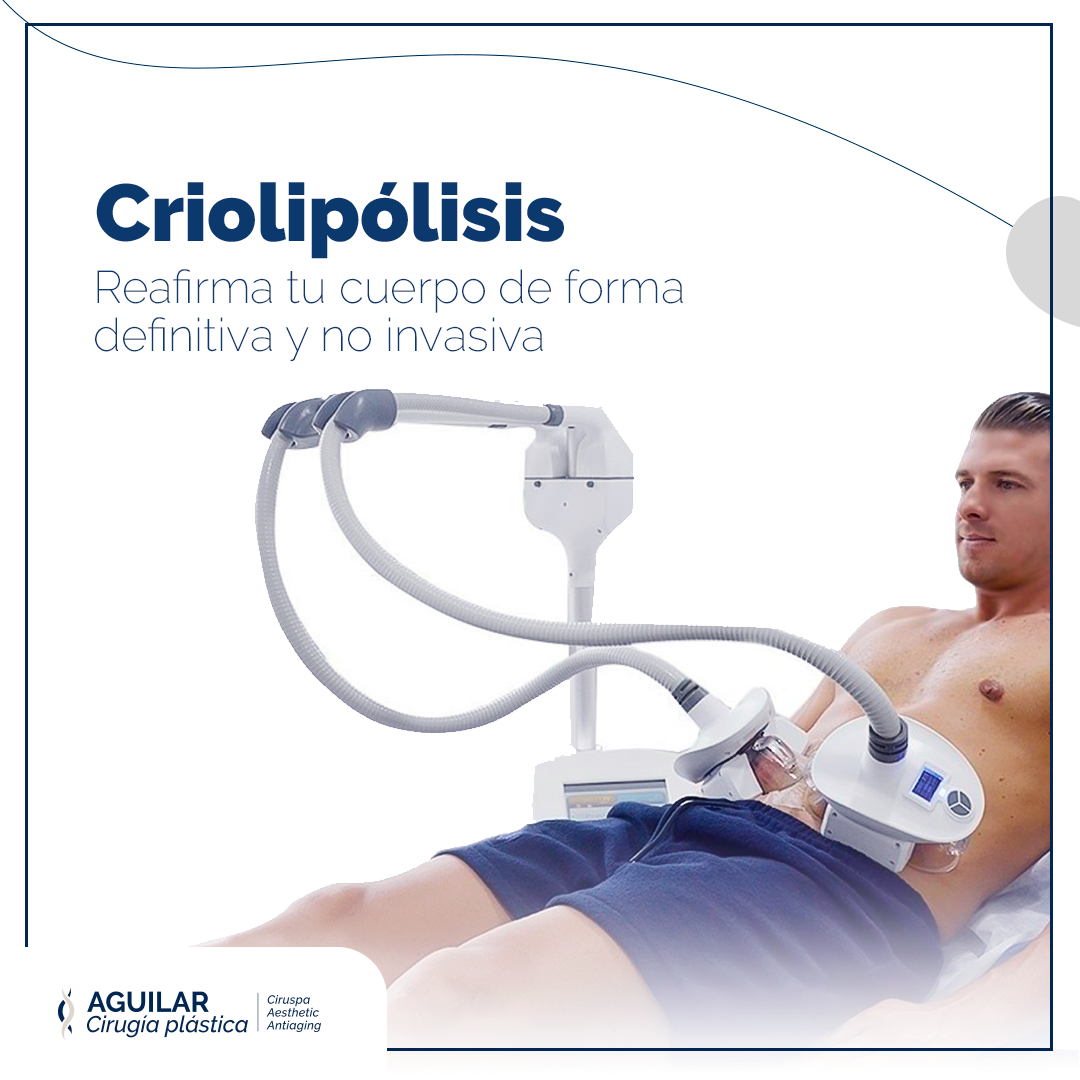 criolipolisis